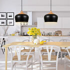 Js-p211-1 Exbrite Black Pendant Light