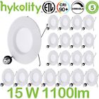 Hy-d615w5k-20 Hykolity Led Dimmable Can Lights Trim Ceiling Downlight Daylight Pack